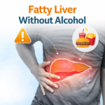 fatty liver prevention lifestyle healthy food and exercise concept