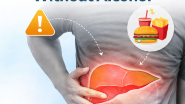 fatty liver prevention lifestyle healthy food and exercise concept