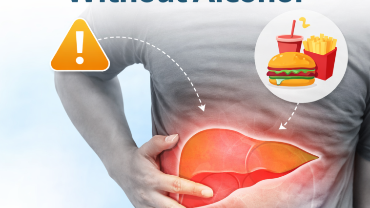 fatty liver prevention lifestyle healthy food and exercise concept