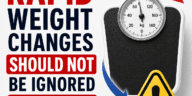 why rapid weight changes should not be ignored