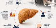 why desk jobs increase fatty liver risk